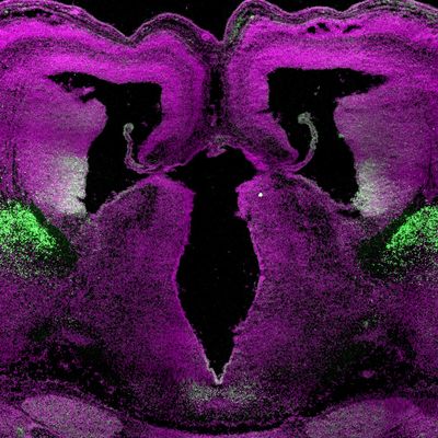 Del Monte Institute for Neuroscience pilot grant program makes institute history