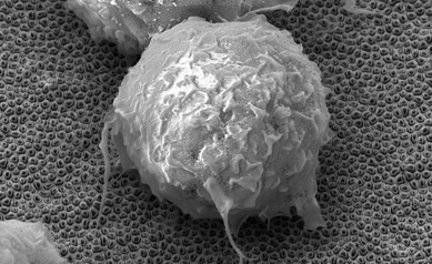 A scanning electron micrograph (SEM) of a macrophage cell sitting on top of the bed of carbon nanotubes.