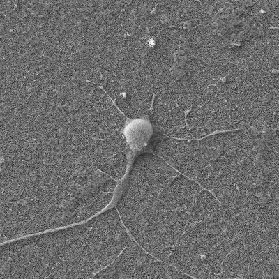 URMC & RIT faculty awarded patent for gene transfer technology that could transform cancer therapies