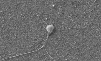 URMC & RIT faculty awarded patent for gene transfer technology that could transform cancer therapies