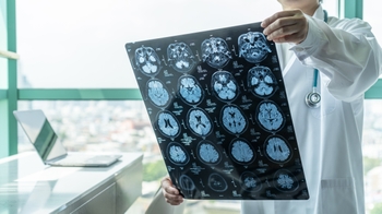 Doctor holding brain scans