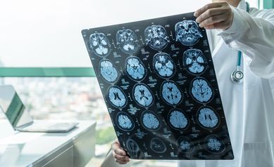 ABCD Study MRIs reveal more incidental findings in children