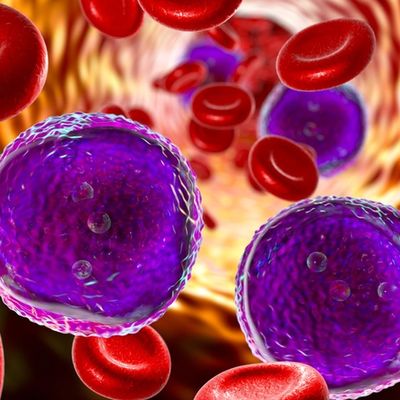 Acute lymphoblastic leukemia
