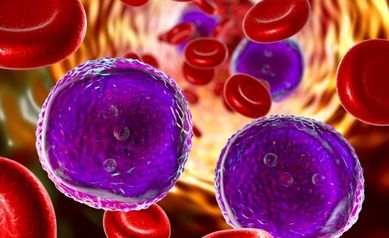 Acute lymphoblastic leukemia