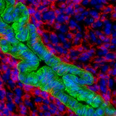 Building on Prior Research, Wilmot Makes Progress on Vexing Liver Cancer