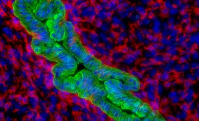Building on Prior Research, Wilmot Makes Progress on Vexing Liver Cancer
