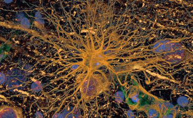 New Grant Will Unlock Workings of Brain’s Waste Removal System