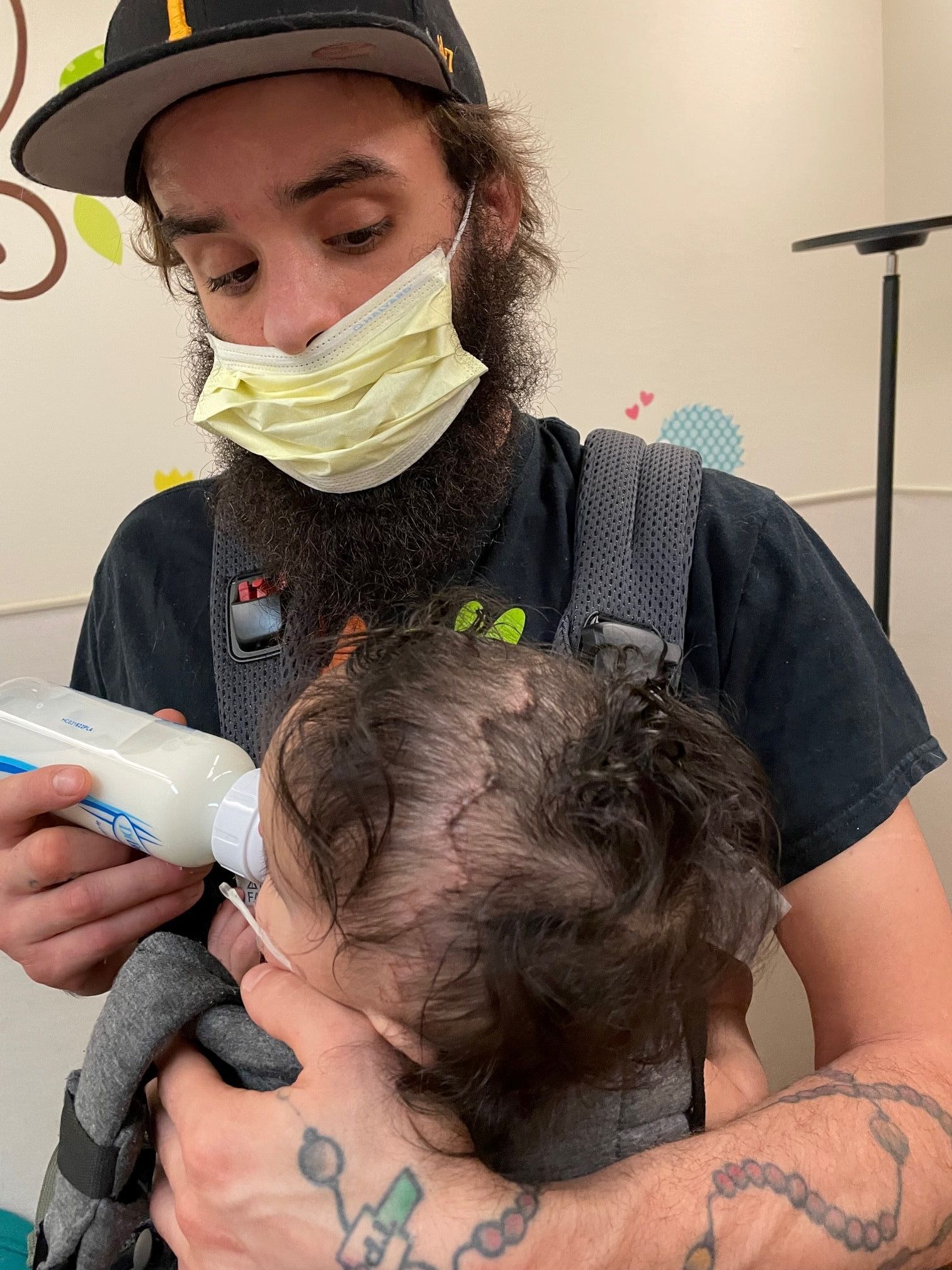 Freddie craniosynostosis