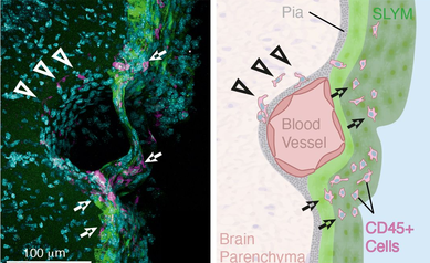 SLYM blood vessel immune cells