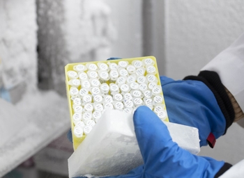 Wilmot Cancer Institute Biobank Shared Resource