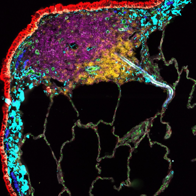 Uncovering the Secrets of the Lung, One Cell at a Time