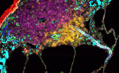 Uncovering the Secrets of the Lung, One Cell at a Time