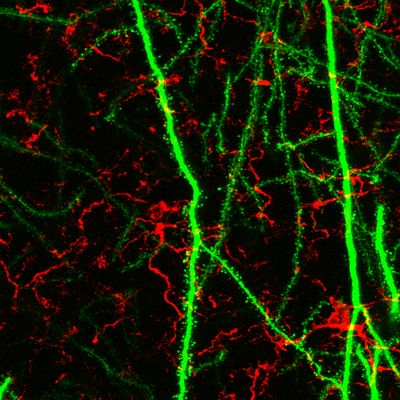 Researchers identify path to prevent cognitive decline after radiation