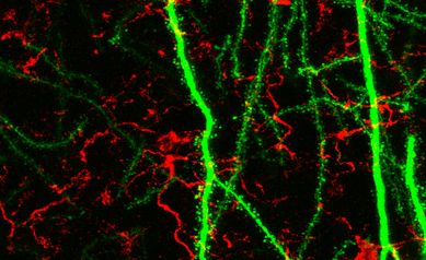 Researchers identify path to prevent cognitive decline after radiation
