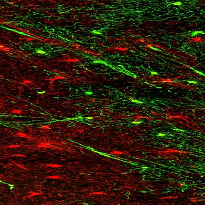 goldman young v old glia 3 sm