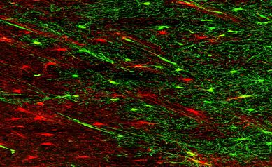 goldman young v old glia 3 sm