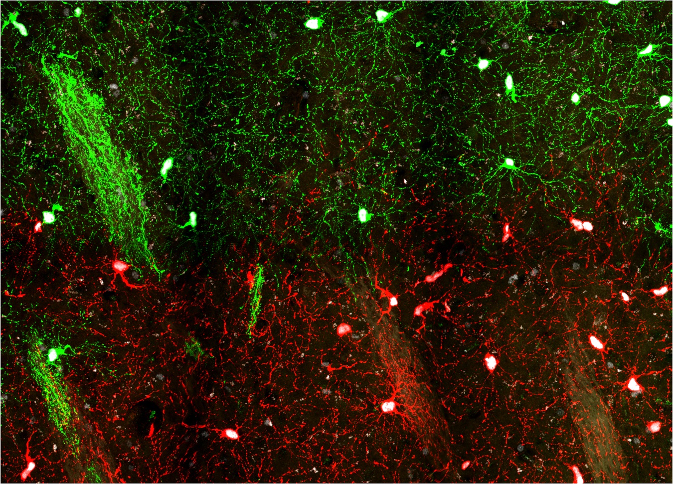 goldman young v old glia 2 sm