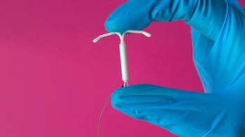 IUD, Intrauterine Device