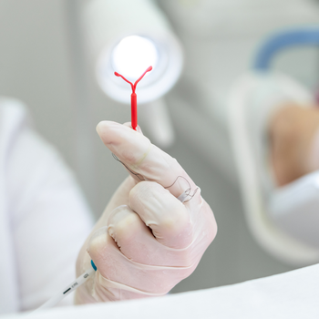 iud birth control