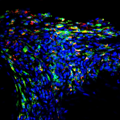 TBP-NP macrophage Figure 6_SciAdv image