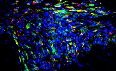 TBP-NP macrophage Figure 6_SciAdv image