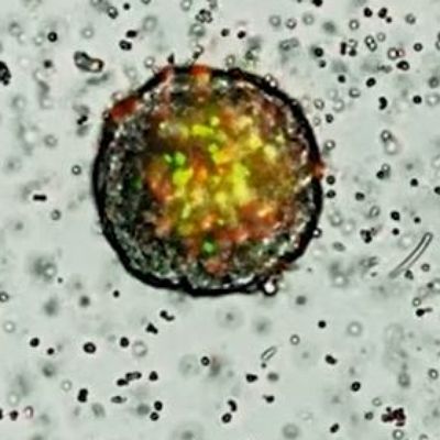 Minsoo-Kim_Neutrophils-attack-tumor 002 - still shot
