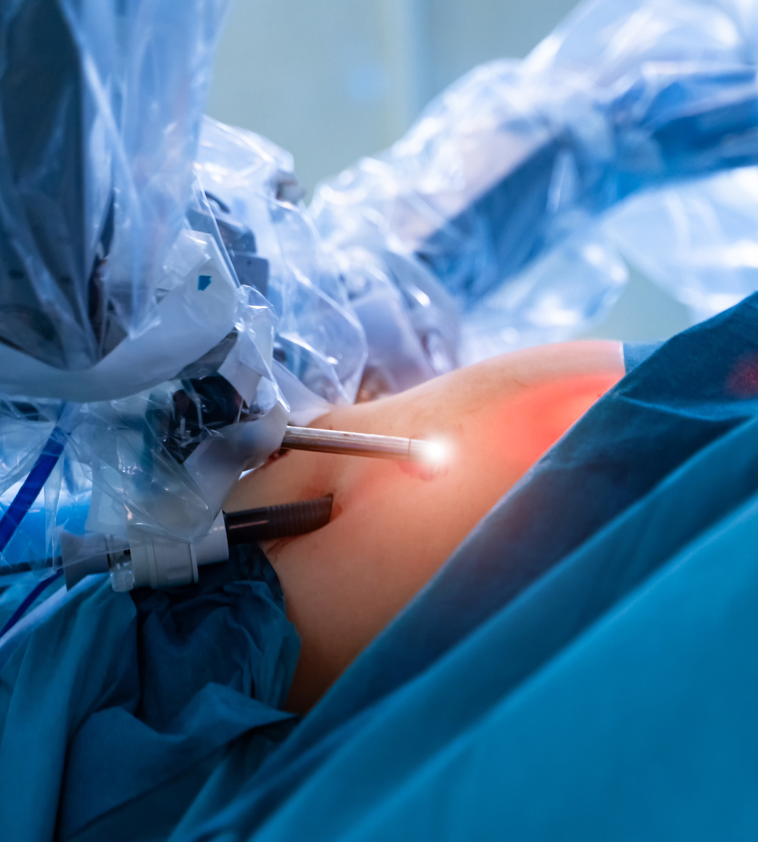 close up of gastric bypass surgery