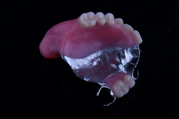 the bottom view of an obturator, a removable piece similar to a retainer or dentures, which includes replacement teeth and flat parts to cover holes in the palate