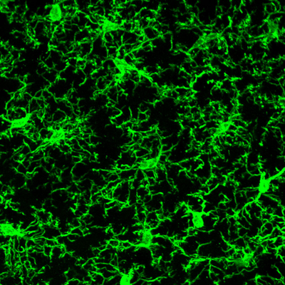 Brain Immune Cells May also be From Mars and Venus