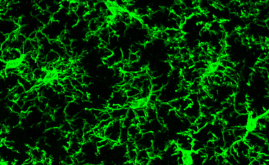 Brain Immune Cells May also be From Mars and Venus