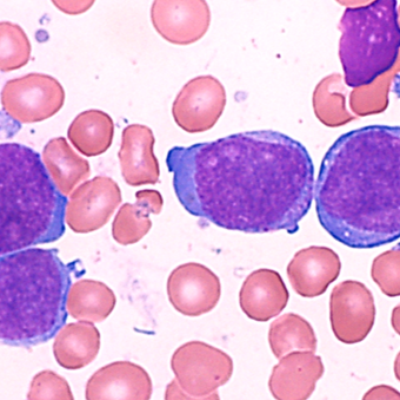 blood cells