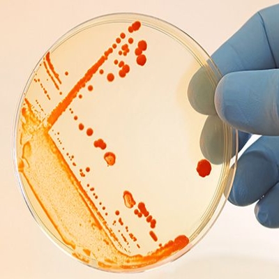 Can Men Get Bacterial Vaginosis?