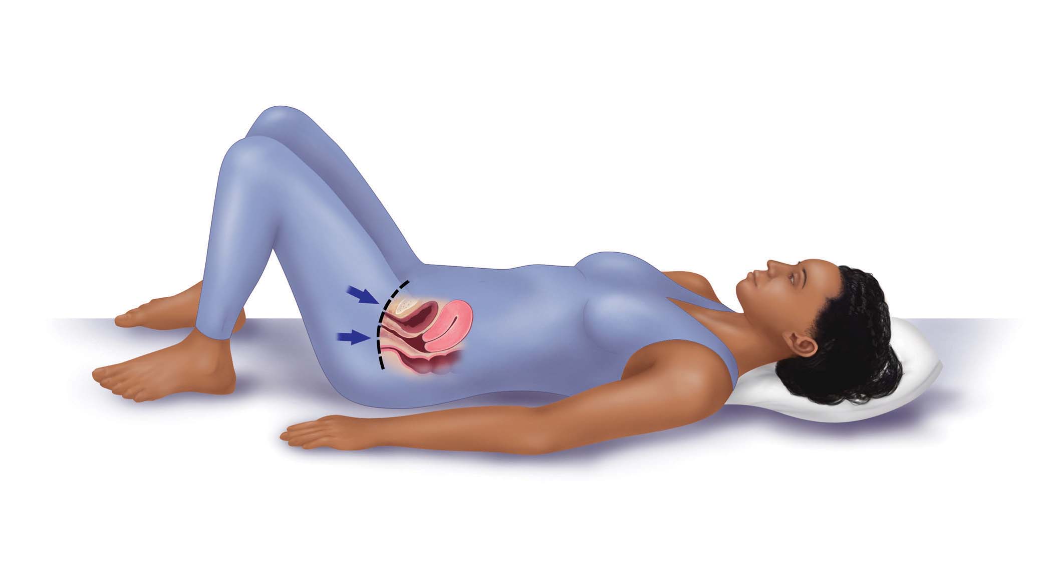 Graphic of a woman lying on her back, indicating her pelvic muscles