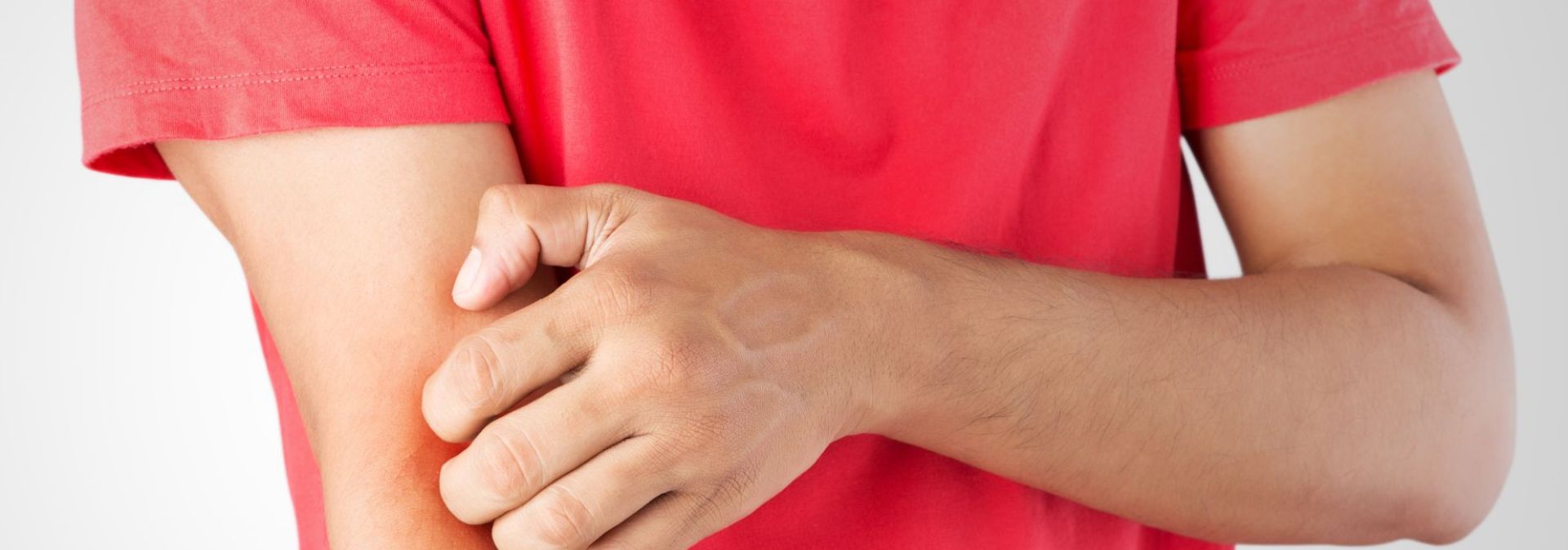 Itching to Know: When to Seek Medical Attention for a Rash | URMC Newsroom