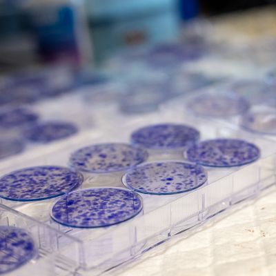 cancer lab photo - Witherow 2024