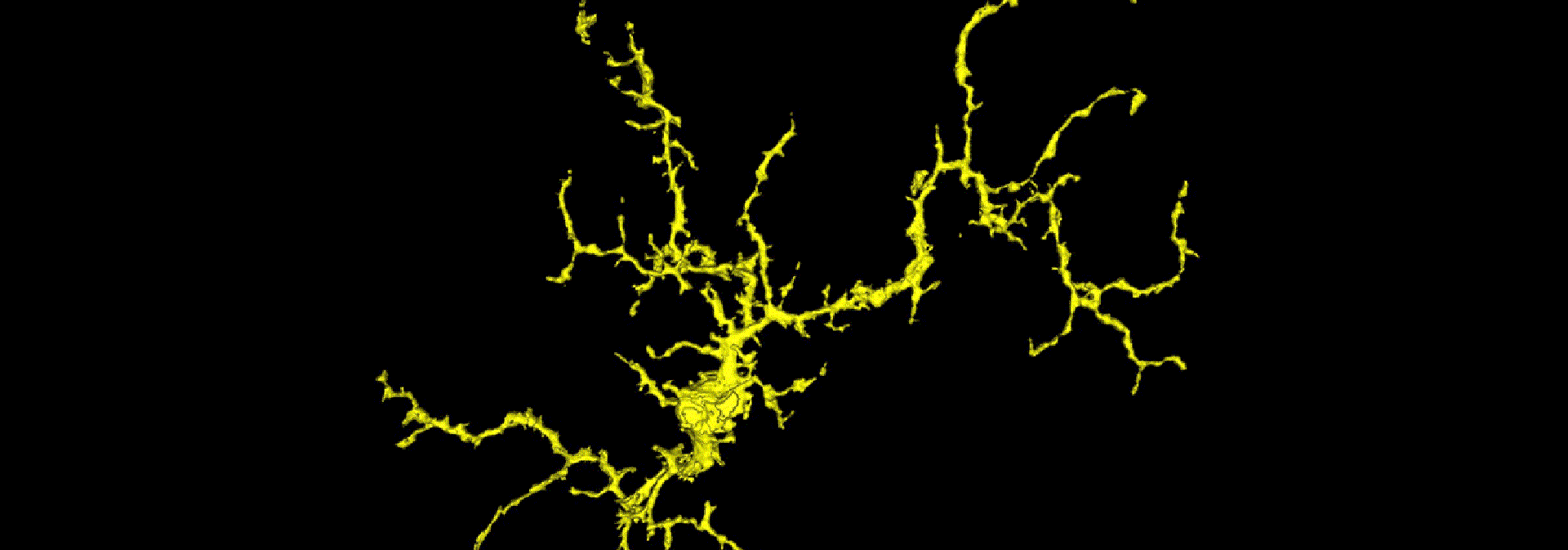 Researchers Find Brain Immune Cells Regulate Vision Health