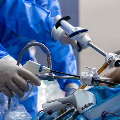 laproscopic surgery Getty_11zon