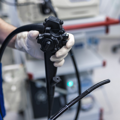 colonoscopy what it can tell you