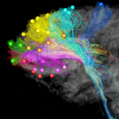 Brain networks and circuitry 2
