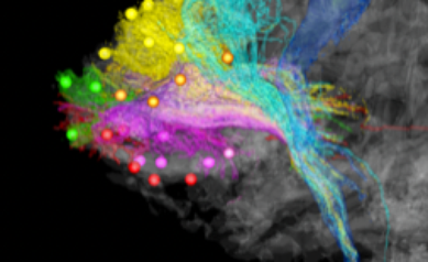 Brain networks and circuitry 2