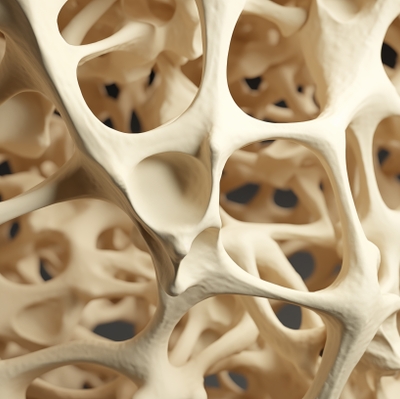 Osteoporosis what does it look like