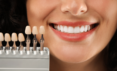 Should I Get Veneers? Consider These 5 Things First