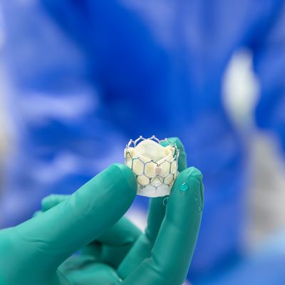 Younger Adults Face Risks With ‘Quick-Fix’ for Heart Valve Surgery