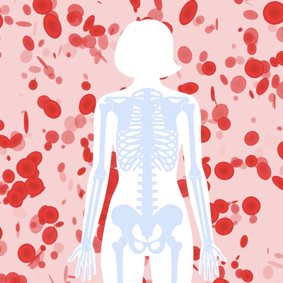 taurine bone marrow cancer