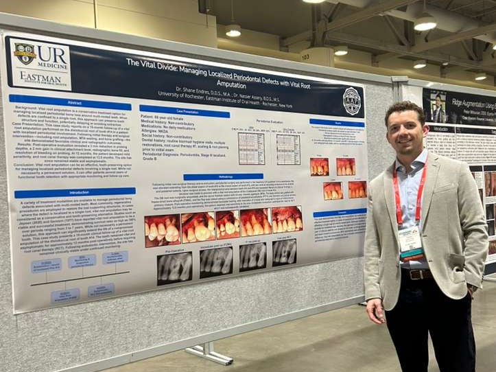 A man stands in front of a scientific poster titled "The Vital Divide: Managing Localized Periodontal Defects with Vital Root Amputation” .