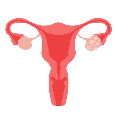 Drawing diagram of a uterus