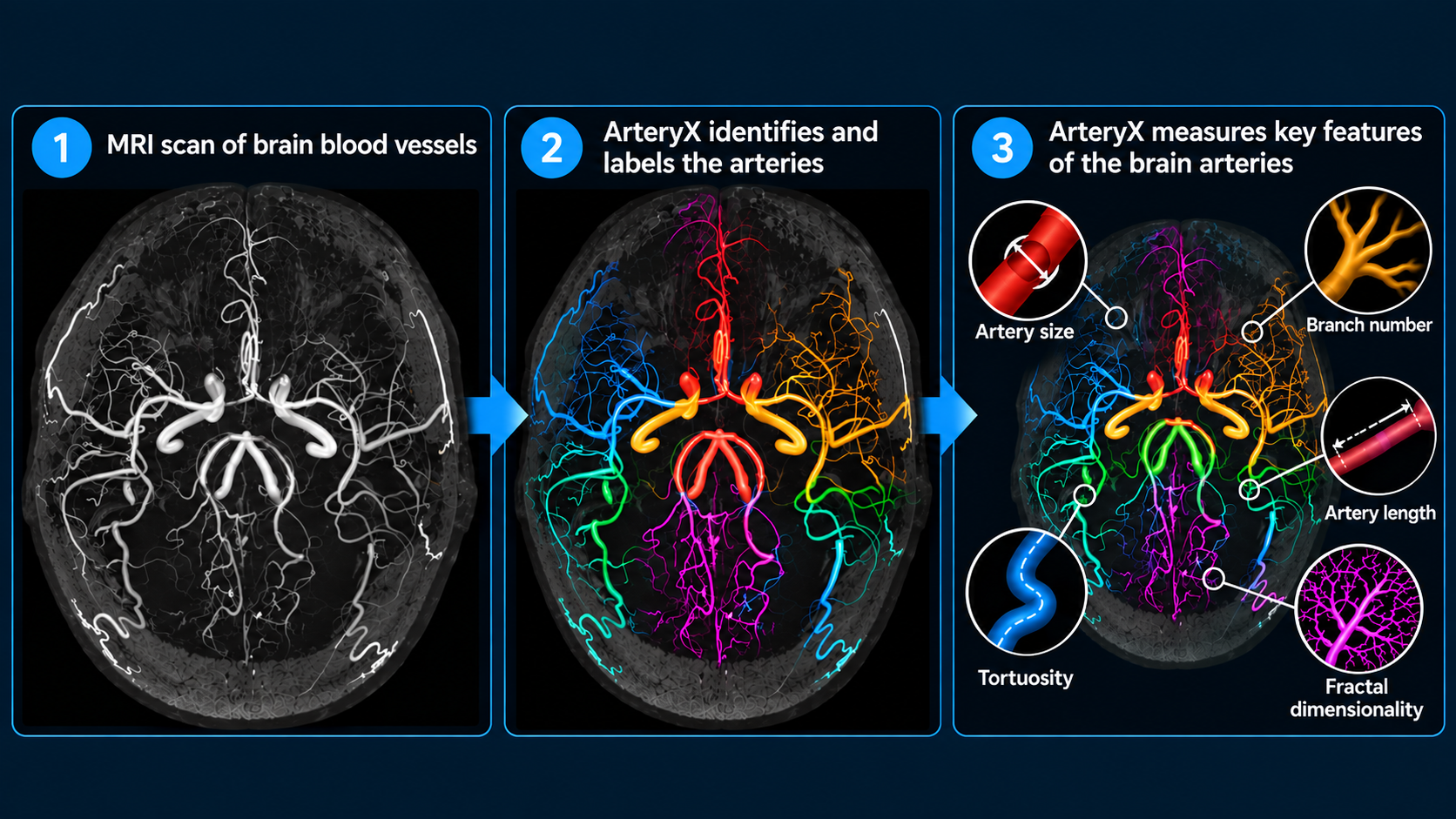 Figure show how ArteryX analyzes MRI images of the brain's vascular system. 