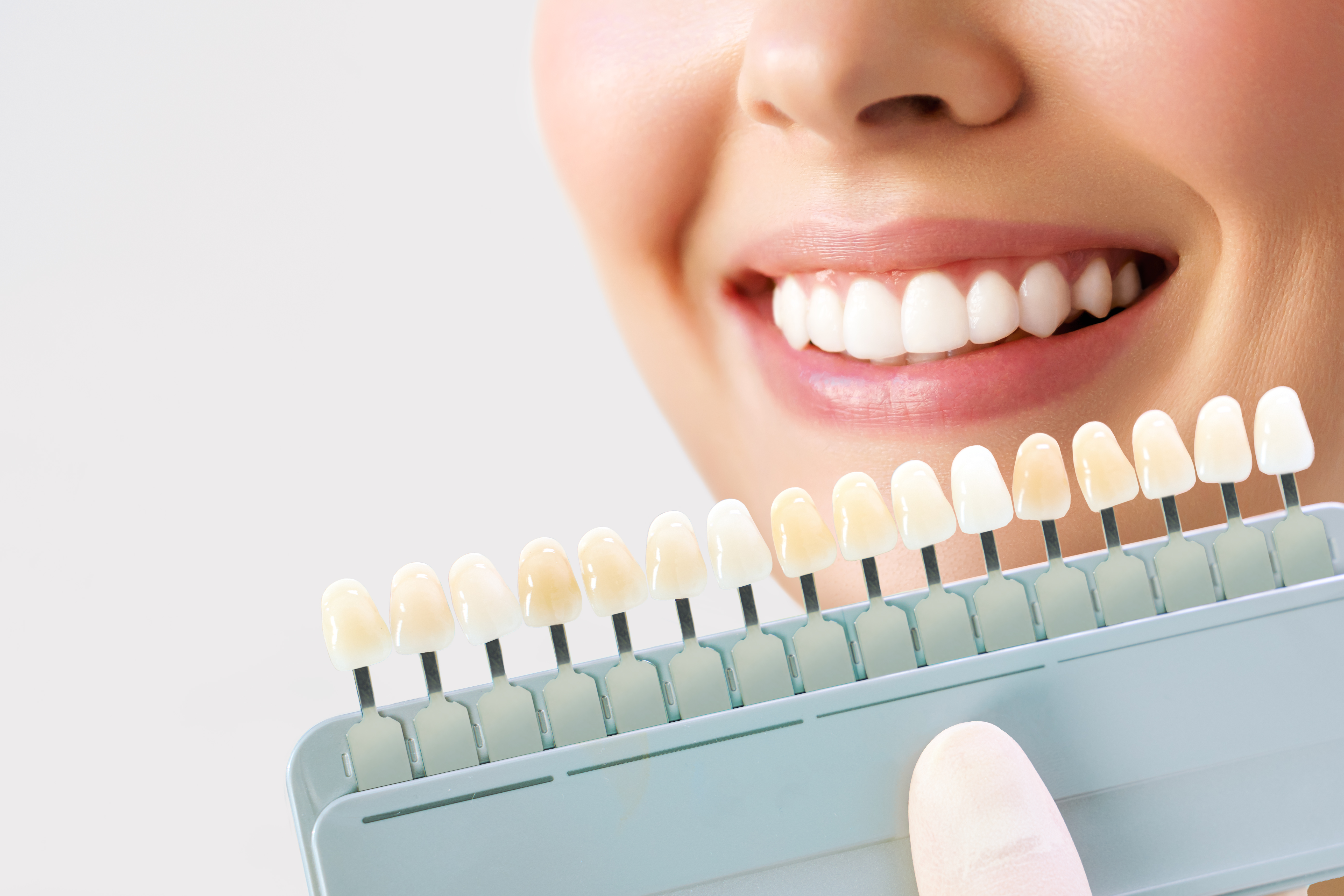 A dentist holds up a range of teeth colors to a patient's smile