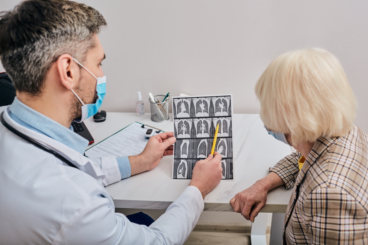 Las nuevas directrices para la detección del cáncer de pulmón destacan la importancia de la detección temprana