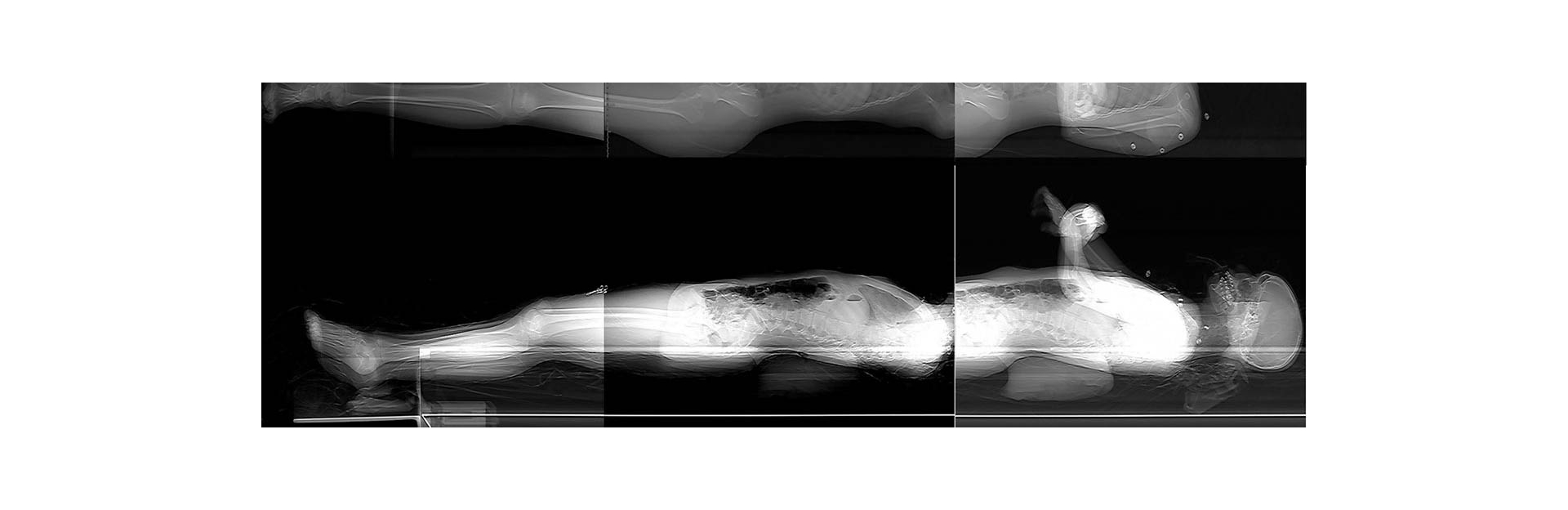 full-body-xray-banner